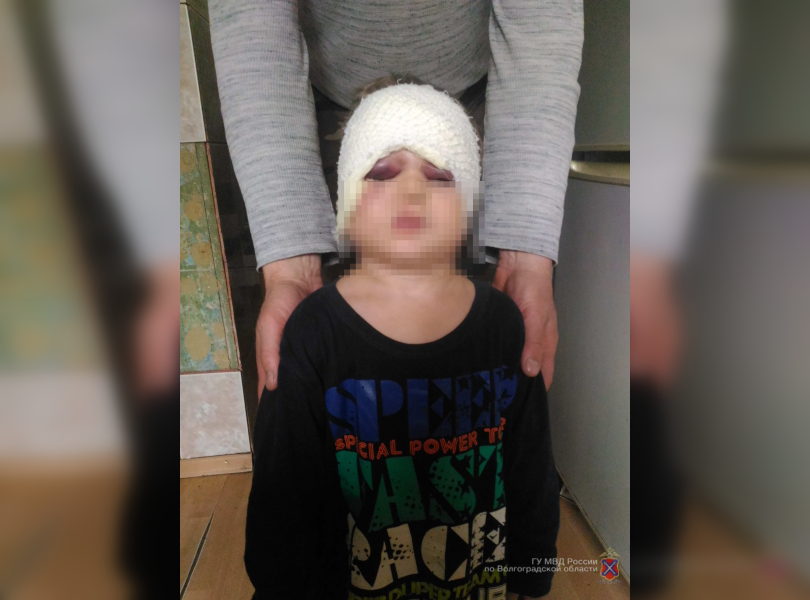 В Волжском ранее судимый пьяный отчим избил трехлетнего ребенка на разрисованные обои