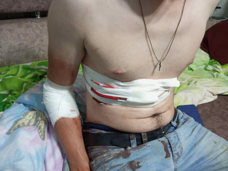 Волгоградец вмешался в семейный конфликт и уехал из гостей на «скорой»